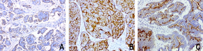 MUC1 Antibody in Immunohistochemistry (Paraffin) (IHC (P))