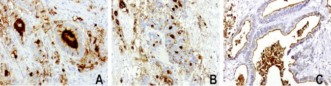 MUC1 Antibody in Immunohistochemistry (Paraffin) (IHC (P))