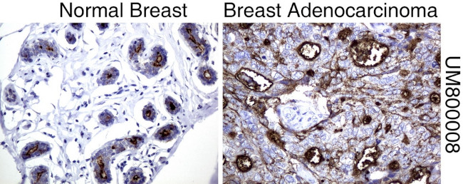 MUC1 Antibody in Immunohistochemistry (Paraffin) (IHC (P))