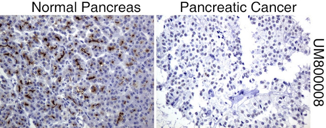 MUC1 Antibody in Immunohistochemistry (Paraffin) (IHC (P))