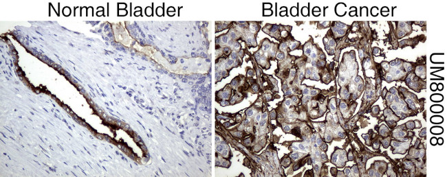 MUC1 Antibody in Immunohistochemistry (Paraffin) (IHC (P))