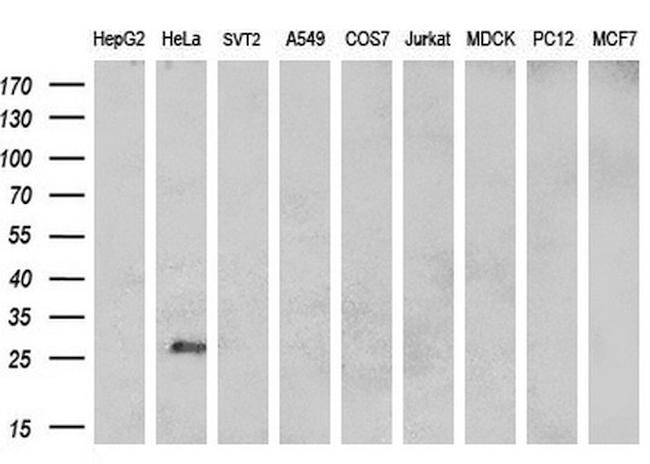 MUC1 Antibody in Western Blot (WB)