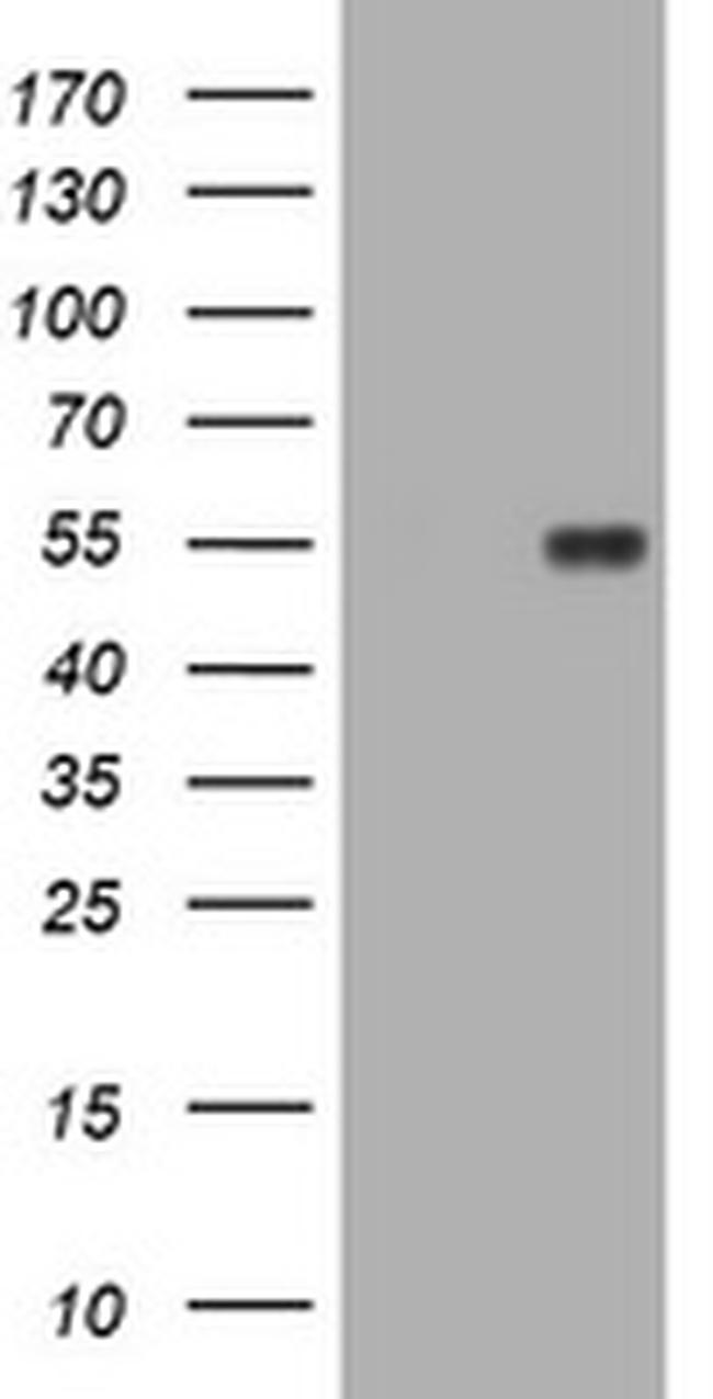 MUC1 Antibody in Western Blot (WB)