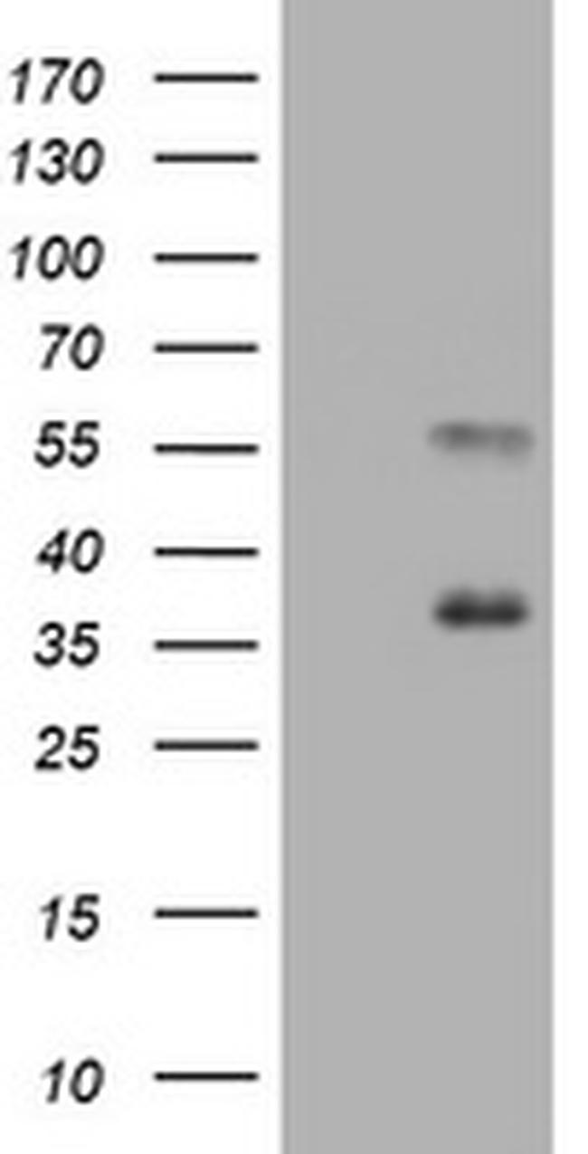 MUC1 Antibody in Western Blot (WB)