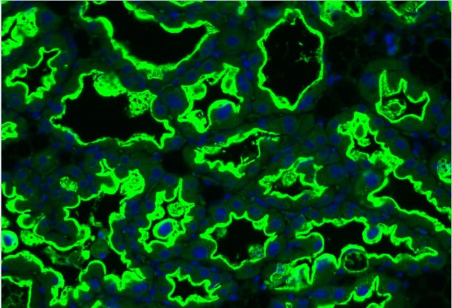 MUC1 Antibody in Immunocytochemistry (ICC/IF)