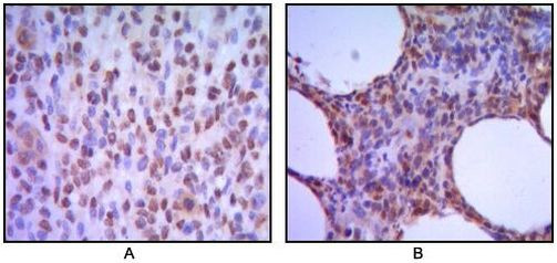 MUM1 Antibody in Immunohistochemistry (Paraffin) (IHC (P))
