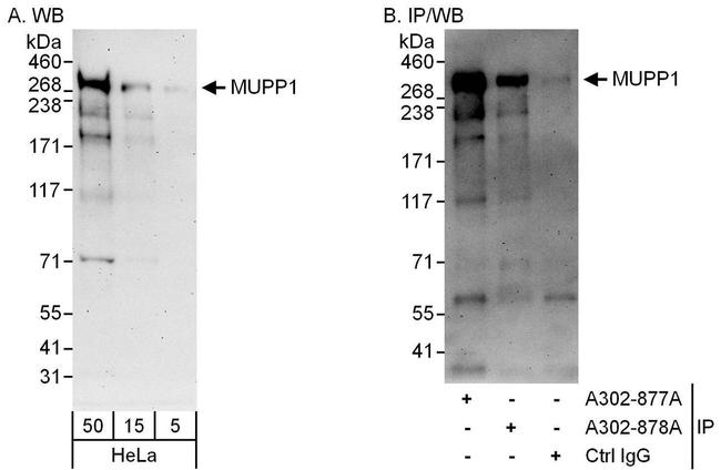 MUPP1 Antibody in Western Blot (WB)