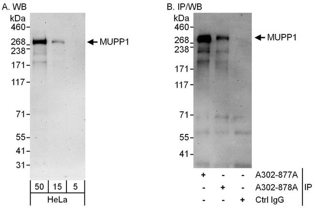 MUPP1 Antibody in Western Blot (WB)