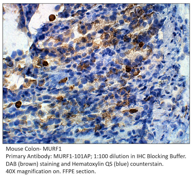 MURF1 Antibody in Immunohistochemistry (IHC)