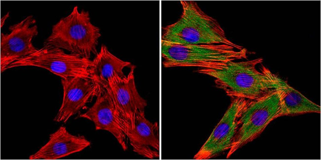 MUSK Antibody in Immunocytochemistry (ICC/IF)