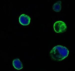 MUSK Antibody in Immunocytochemistry (ICC/IF)