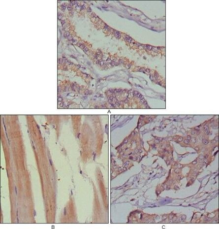 MUSK Antibody in Immunohistochemistry (Paraffin) (IHC (P))