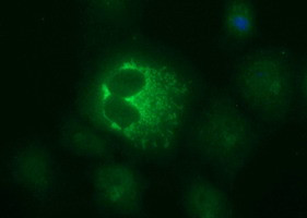 MUT Antibody in Immunocytochemistry (ICC/IF)