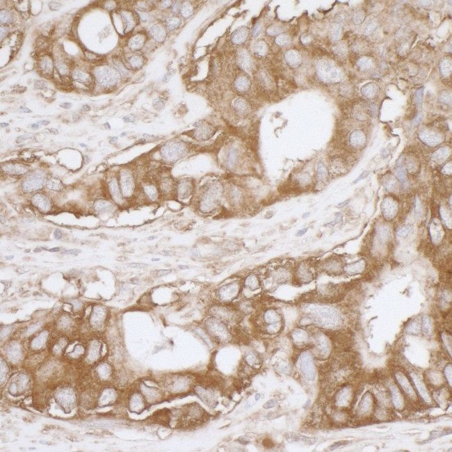 MVP/Major Vault Protein Antibody in Immunohistochemistry (IHC)