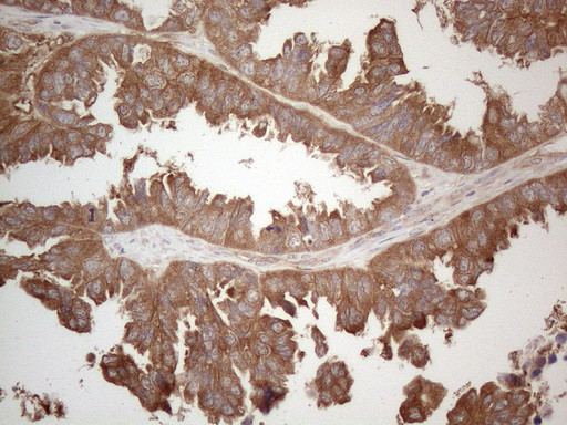 MXD4 Antibody in Immunohistochemistry (Paraffin) (IHC (P))