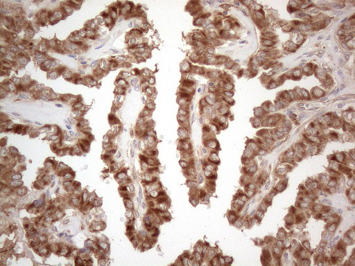 MXD4 Antibody in Immunohistochemistry (Paraffin) (IHC (P))