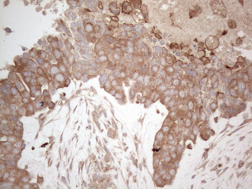 MXD4 Antibody in Immunohistochemistry (Paraffin) (IHC (P))