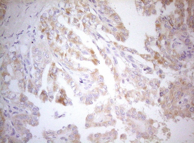 MXD4 Antibody in Immunohistochemistry (Paraffin) (IHC (P))