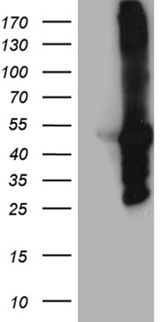 MYBPC2 Antibody in Western Blot (WB)