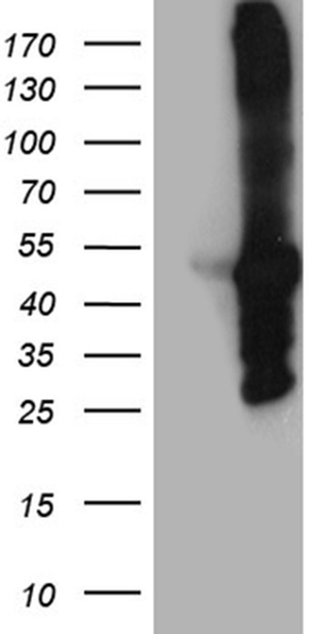 MYBPC2 Antibody in Western Blot (WB)