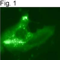 Myc Tag Antibody in Immunocytochemistry (ICC/IF)