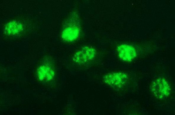 MYC Antibody in Immunocytochemistry (ICC/IF)