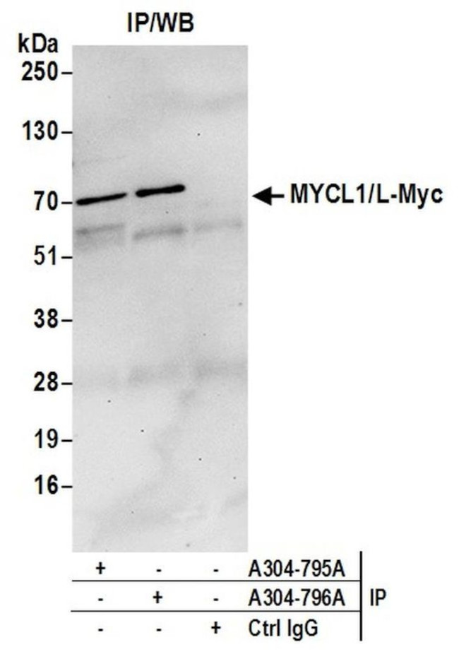 MYCL1/L-Myc Antibody in Immunoprecipitation (IP)