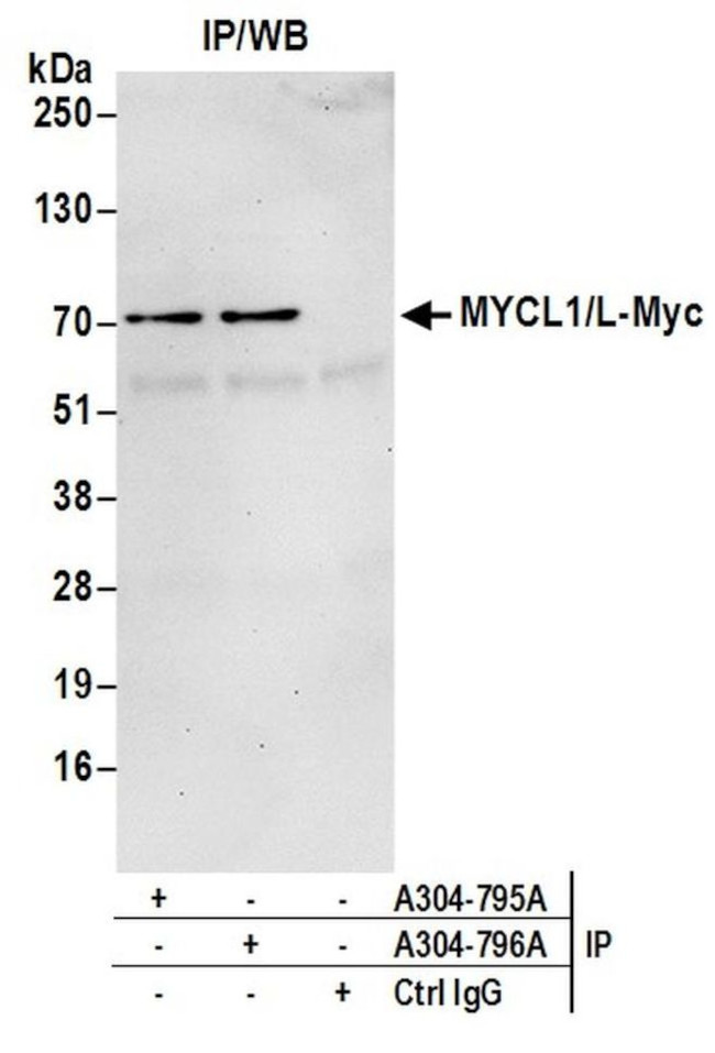 MYCL1/L-Myc Antibody in Immunoprecipitation (IP)