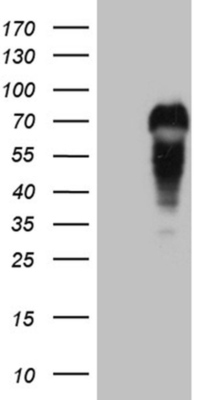 MYCN Antibody in Western Blot (WB)