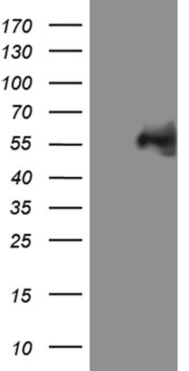 MYCN Antibody in Western Blot (WB)