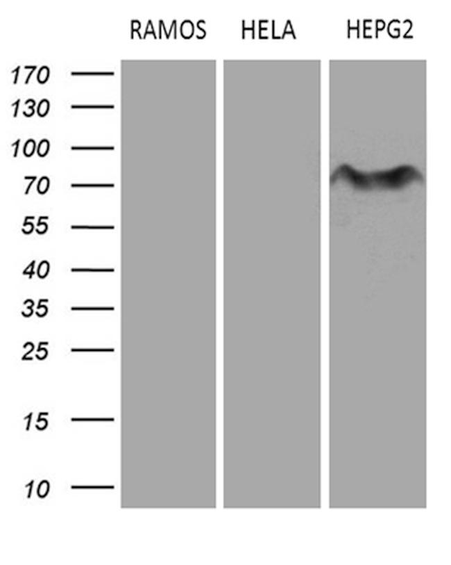 MYCN Antibody in Western Blot (WB)