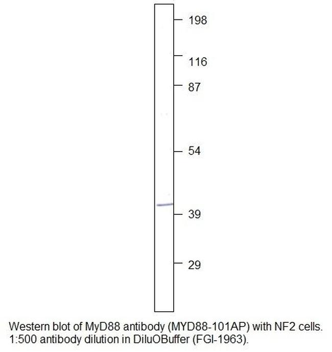 MyD88 Antibody in Western Blot (WB)