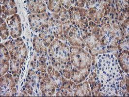 MYD88 Antibody in Immunohistochemistry (Paraffin) (IHC (P))