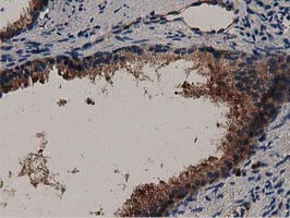 MYD88 Antibody in Immunohistochemistry (Paraffin) (IHC (P))