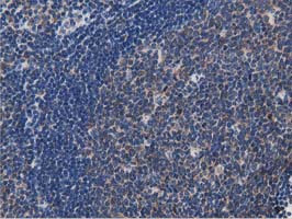 MYD88 Antibody in Immunohistochemistry (Paraffin) (IHC (P))