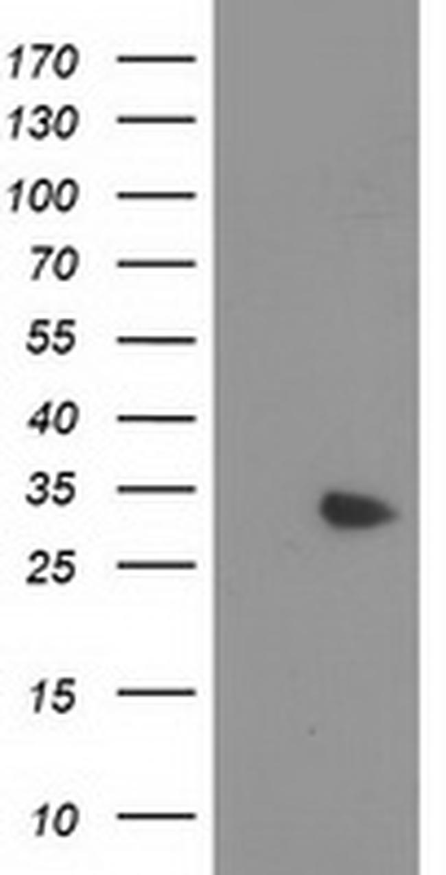 MYD88 Antibody in Western Blot (WB)