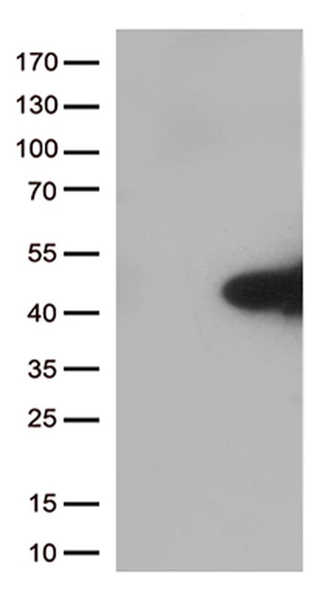 MYD88 Antibody in Western Blot (WB)