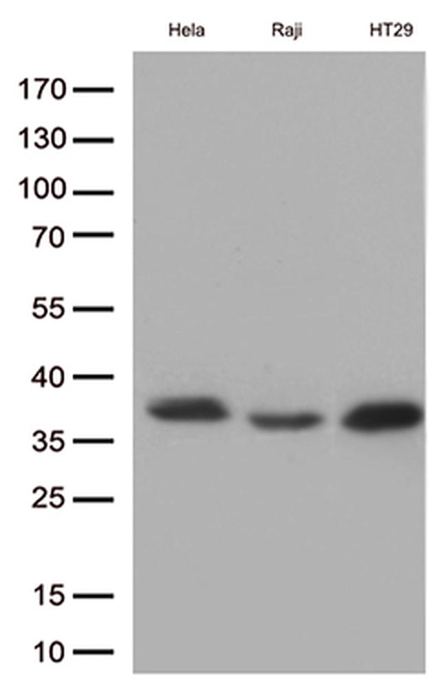 MYD88 Antibody in Western Blot (WB)
