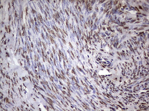 MYF5 Antibody in Immunohistochemistry (Paraffin) (IHC (P))