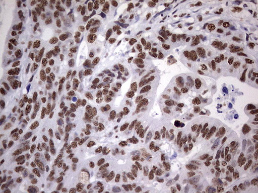 MYF5 Antibody in Immunohistochemistry (Paraffin) (IHC (P))