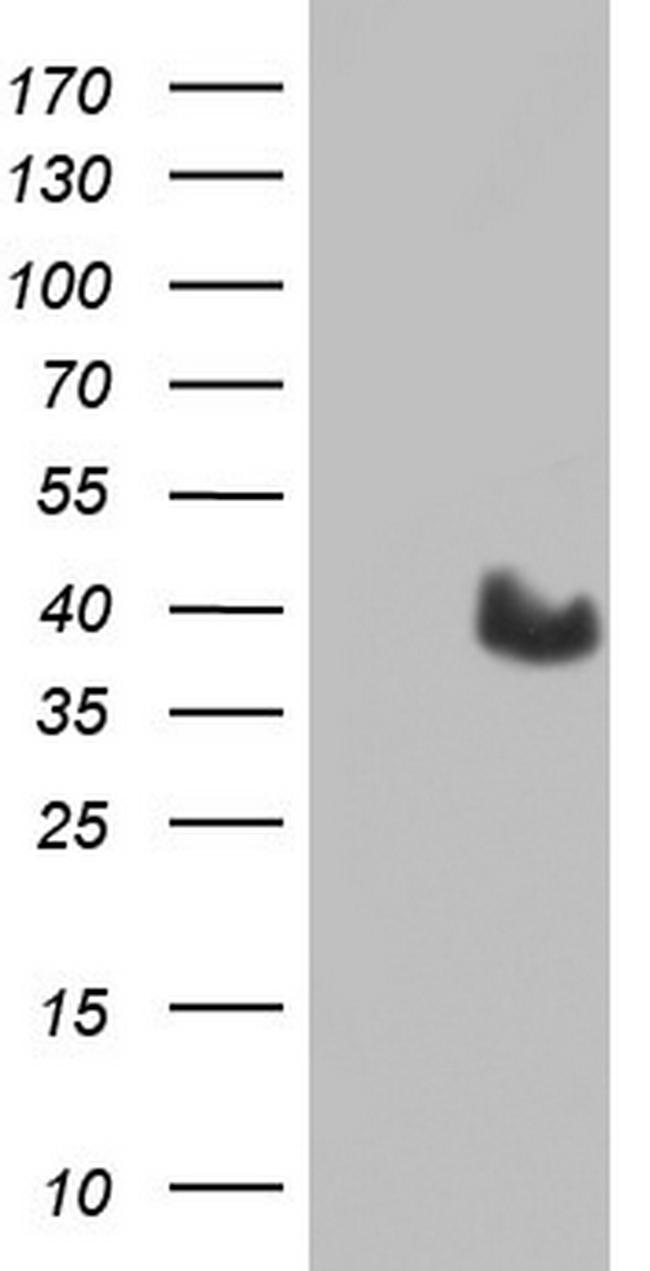 MYF5 Antibody in Western Blot (WB)