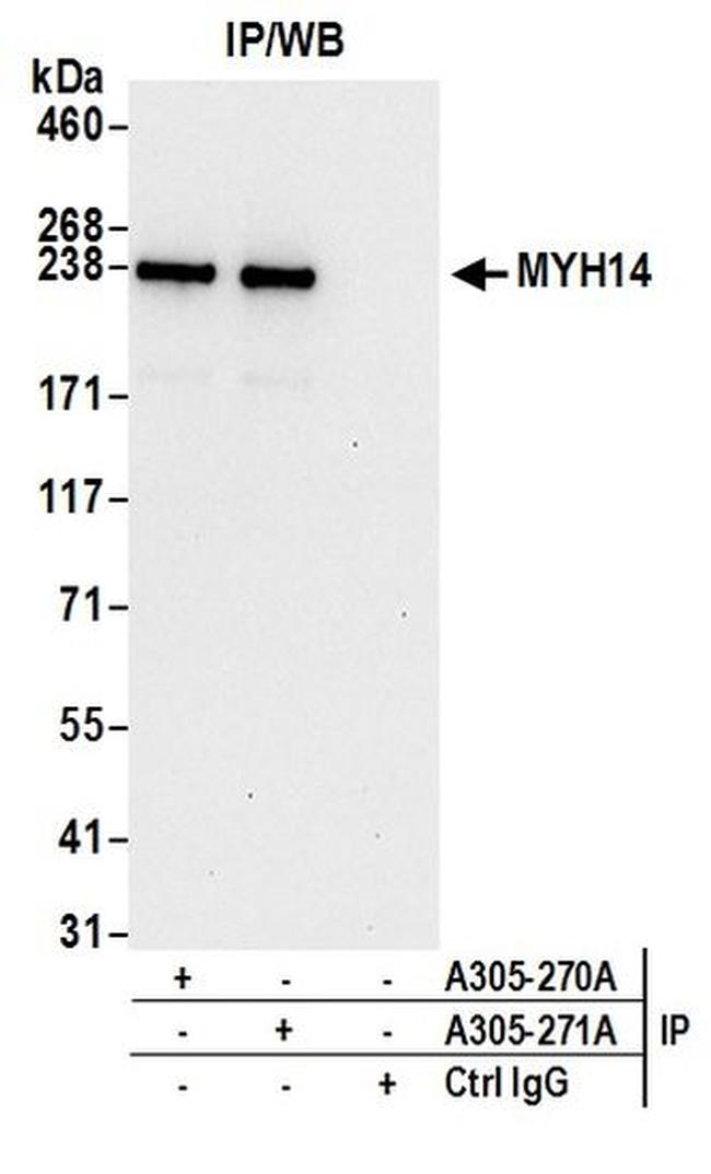 MYH14/Myosin-14 Antibody in Western Blot (WB)