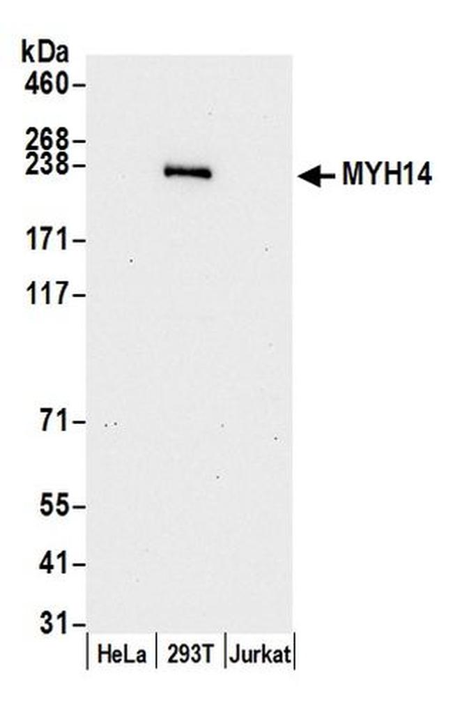 MYH14/Myosin-14 Antibody in Western Blot (WB)