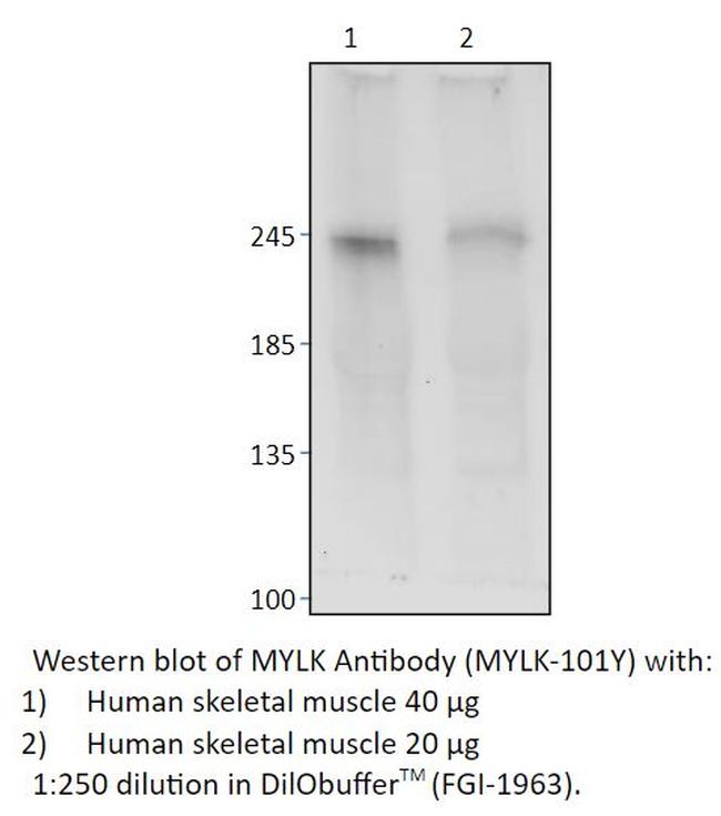 MYLK Antibody in Western Blot (WB)