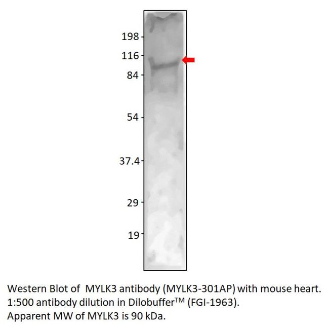 MYLK3 Antibody in Western Blot (WB)