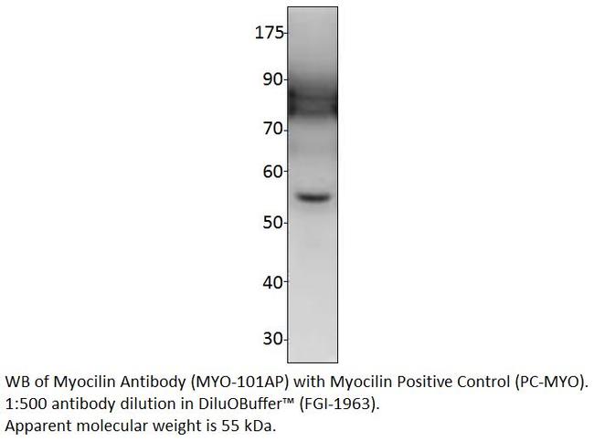 Myocilin Antibody in Western Blot (WB)