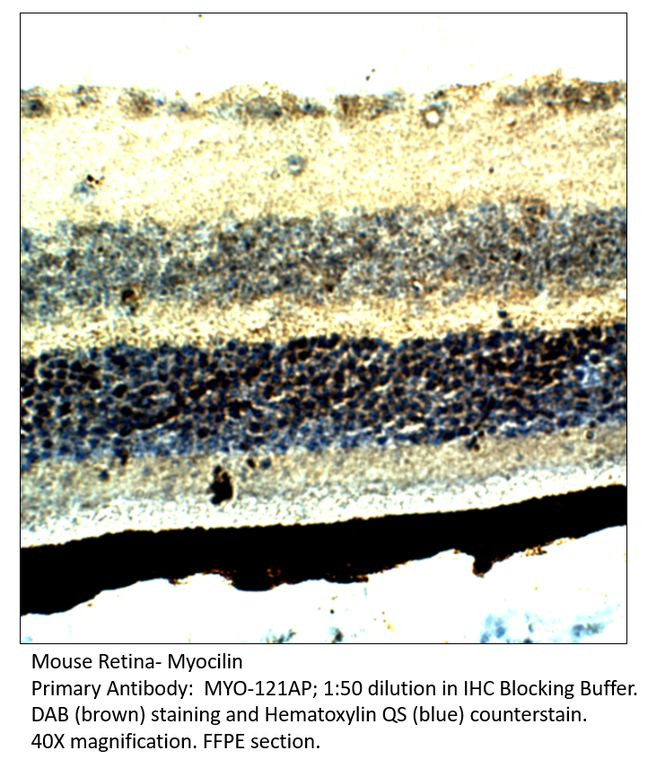 Myocilin Antibody in Immunohistochemistry (IHC)