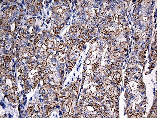 MYO18A Antibody in Immunohistochemistry (Paraffin) (IHC (P))