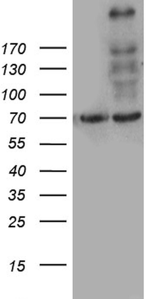 MYO18A Antibody in Western Blot (WB)