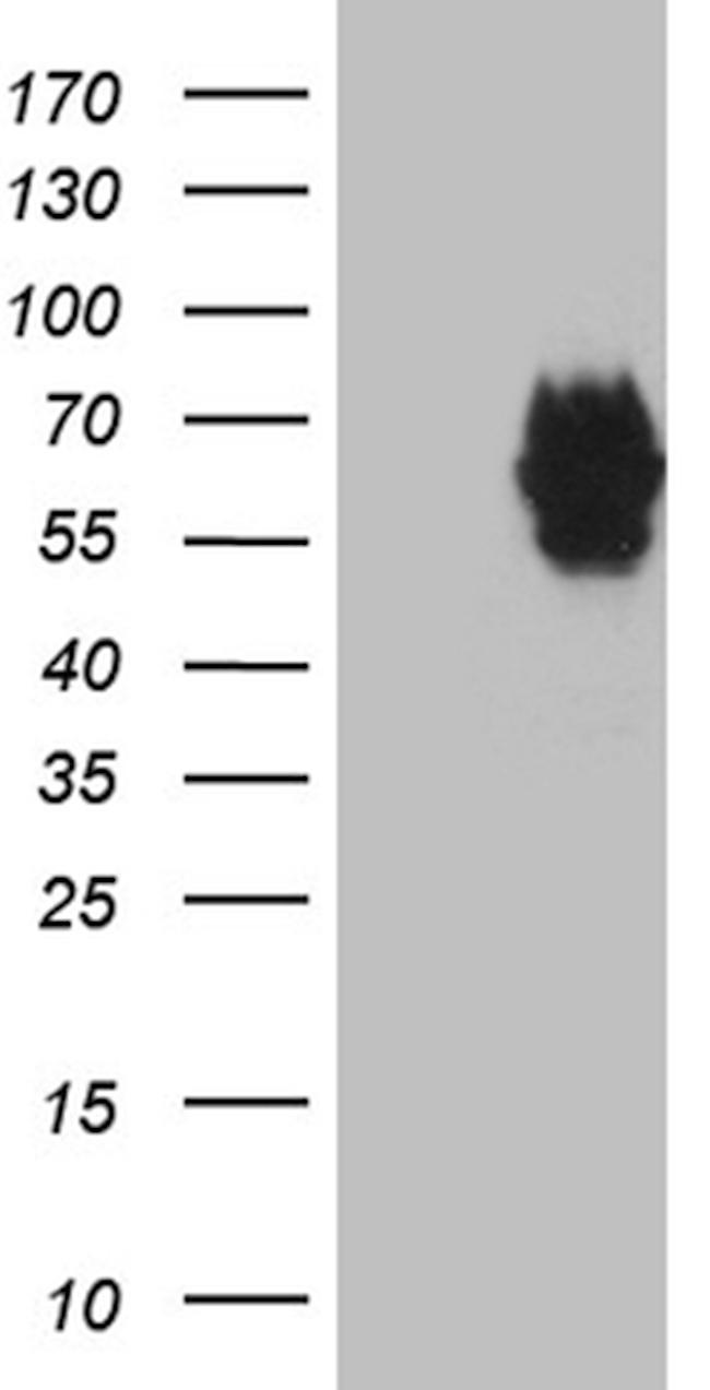 MYOT Antibody in Western Blot (WB)